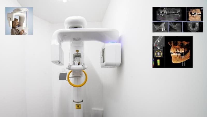 (3D imaging) What is Dental Tomography?